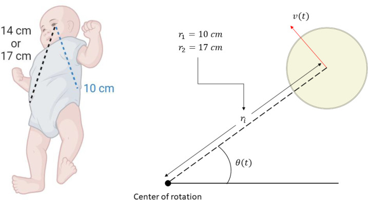 Finite element analysis of asymmetrical retinal hemorrhages in shaken baby syndrome.