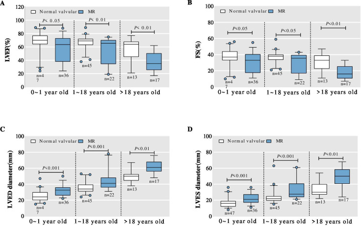 Clinical features of non-compaction cardiomyopathy across age groups: a retrospective study of 415 patients.