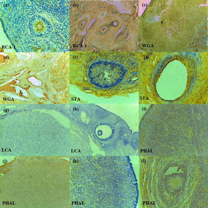 Lectin-Histochemical Pattern on the Cystic and Neoplastic Ovaries of Bitches.