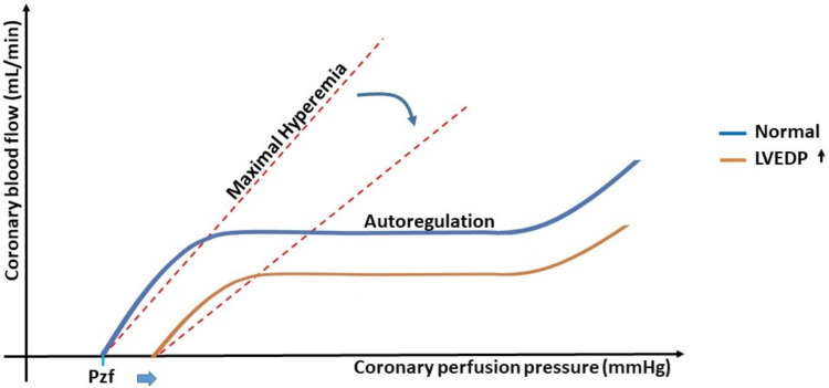 Focusing on microvascular function in heart failure with preserved ejection fraction.