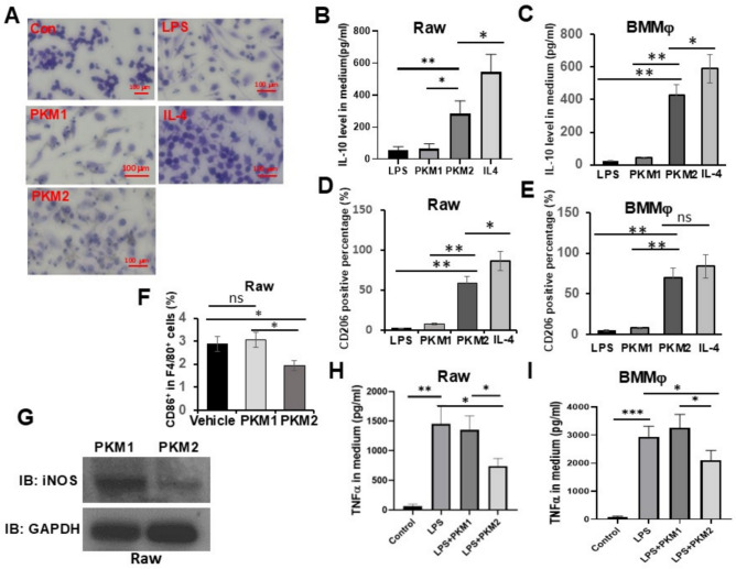 Extracellular PKM2 modulates cancer immunity by regulating macrophage polarity.