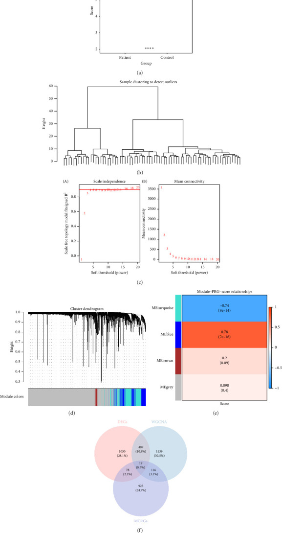 Identification and Experimental Validation of Biomarkers Associated With Mitochondria and Macrophage Polarization in Sepsis.