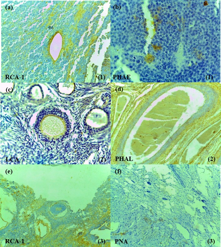Lectin-Histochemical Pattern on the Cystic and Neoplastic Ovaries of Bitches.