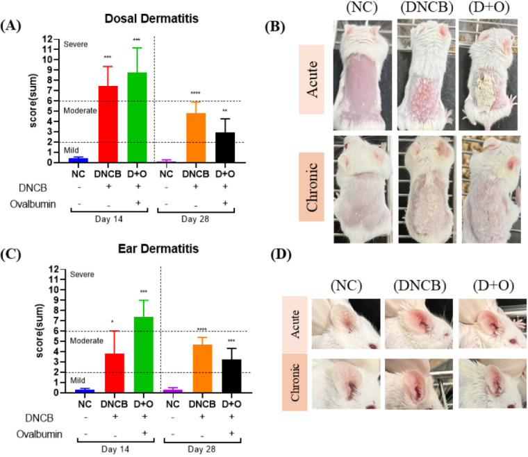 A refined comparative mouse model of acute and chronic atopic dermatitis.