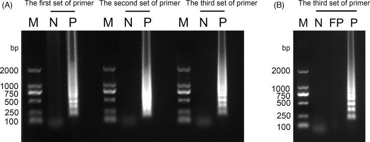 Development of a loop-mediated isothermal amplification assay for the rapid detection of Alongshan virus.