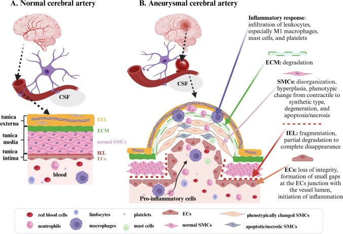 Impact of the Transforming Growth Factor β (TGF-β) on Brain Aneurysm Formation and Development: A Literature Review.