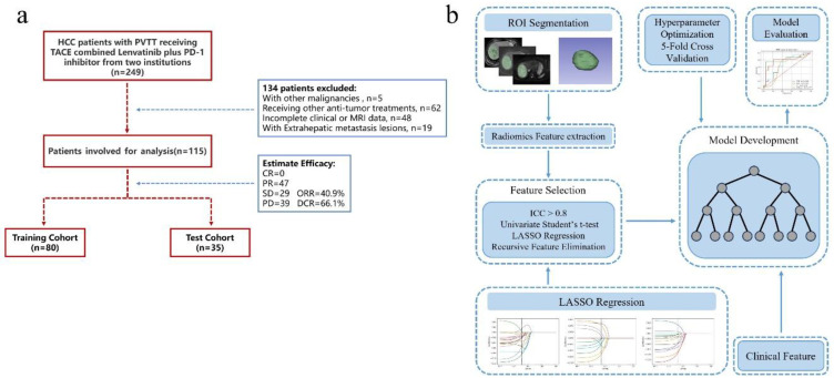 MRI Radiomics to Predict Early Treatment Response to TACE Combined with Lenvatinib Plus a PD-1 Inhibitor for Hepatocellular Carcinoma with Portal Vein Tumor Thrombus.