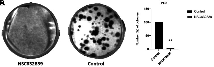 Targeting Prostate Cancer Cells by an Isopeptidase Inhibitor NSC632839.