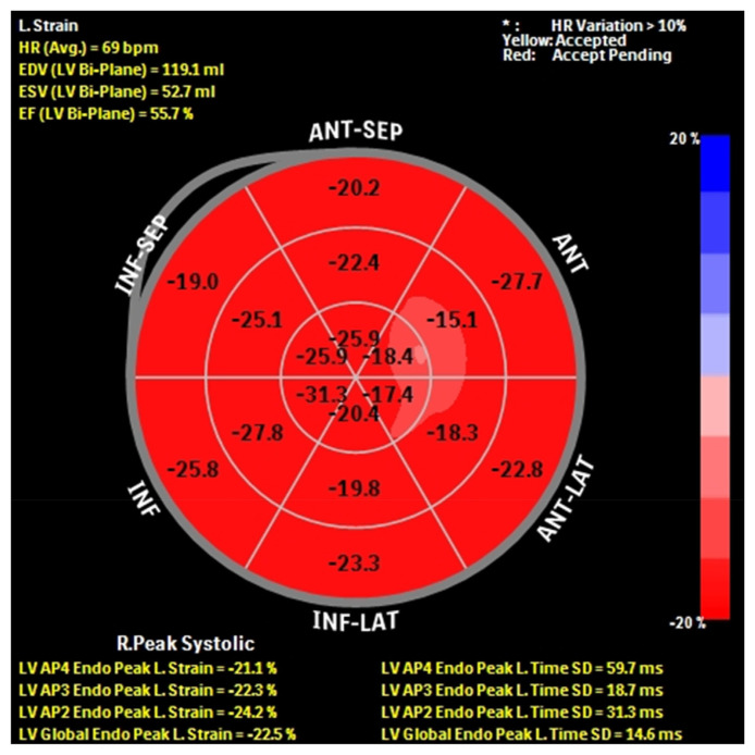 Comparative Analysis of Speckle-tracking Echocardiography and Cardio-specific Markers for Early Detection of Cardiotoxicity in Patients With Breast Cancer.