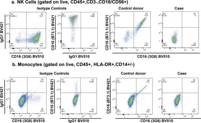 Complete CD16A Deficiency and Defective NK Cell Function in a Man Living with HIV.