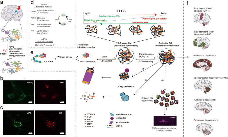 Stress granules: emerging players in neurodegenerative diseases.