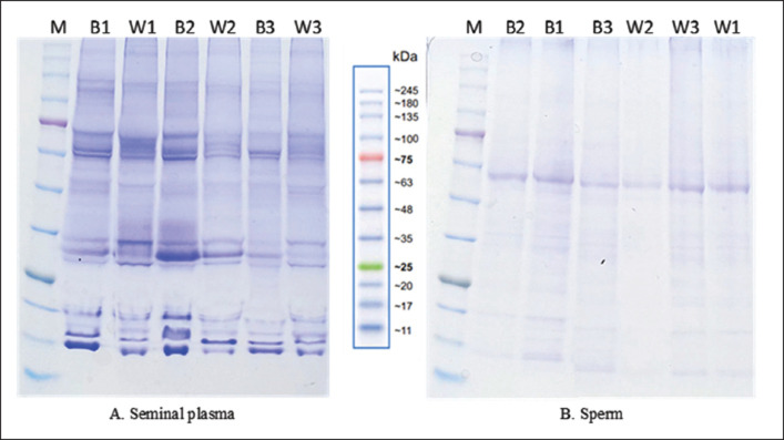 Electrophoretic protein profiles in seminal plasma and sperm: a comparative study of Bali and Wagyu Bulls.