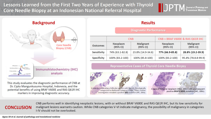 Lessons learned from the first 2 years of experience with thyroid core needle biopsy at an Indonesian national referral hospital.
