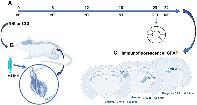 Low-intensity sciatic nerve-stretch injury increases nociception, anxiety-like behaviors, and astrocyte activity in male Wistar rats.