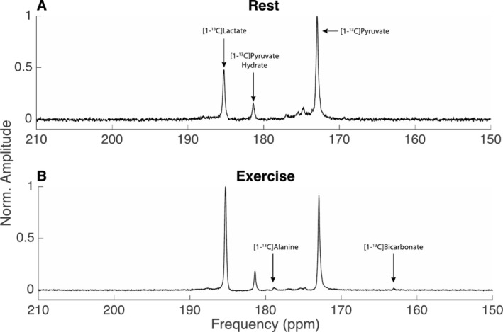 Hyperpolarized <sup>13</sup>C-MRS can Quantify Lactate Production and Oxidative PDH Flux in Murine Skeletal Muscle During Exercise.