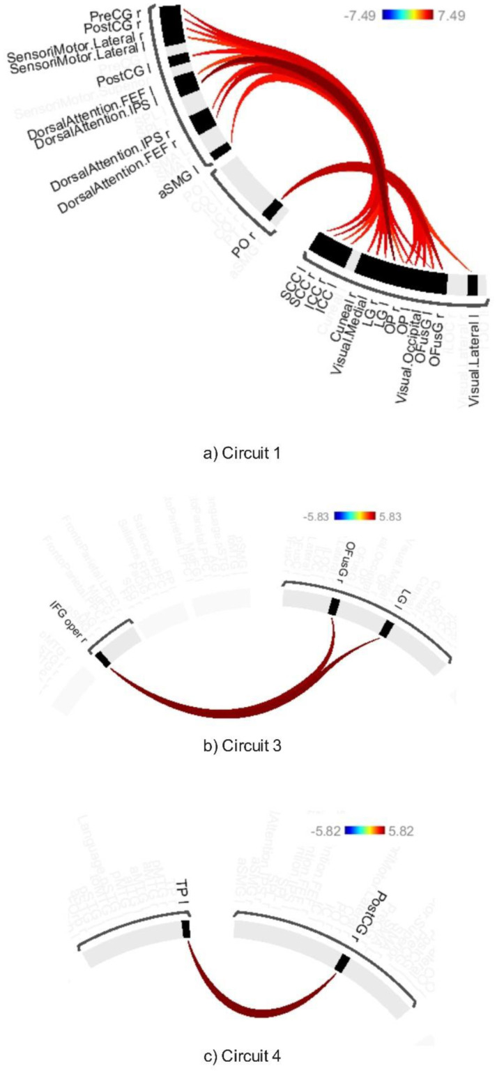 Distinct neural mechanisms of alpha binaural beats and white noise for cognitive enhancement in young adults.