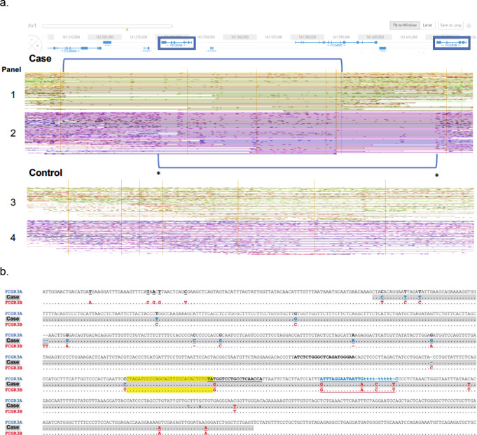 Complete CD16A Deficiency and Defective NK Cell Function in a Man Living with HIV.