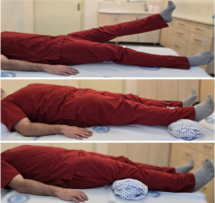 Comparison of open and closed kinetic chain exercises on vastus medialis and vastus medialis oblique in patellofemoral pain syndrome: A randomized, single-blinded, prospective study.