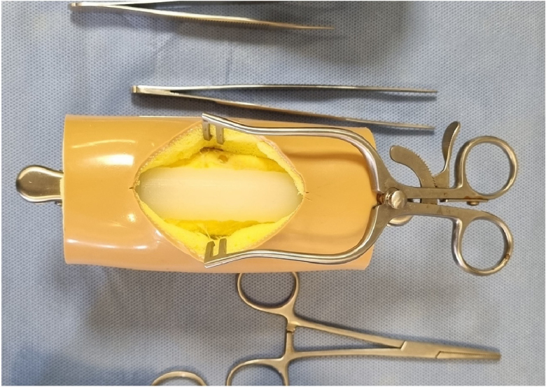 Validation of a novel simulated tendon model for core suture tendon repair.