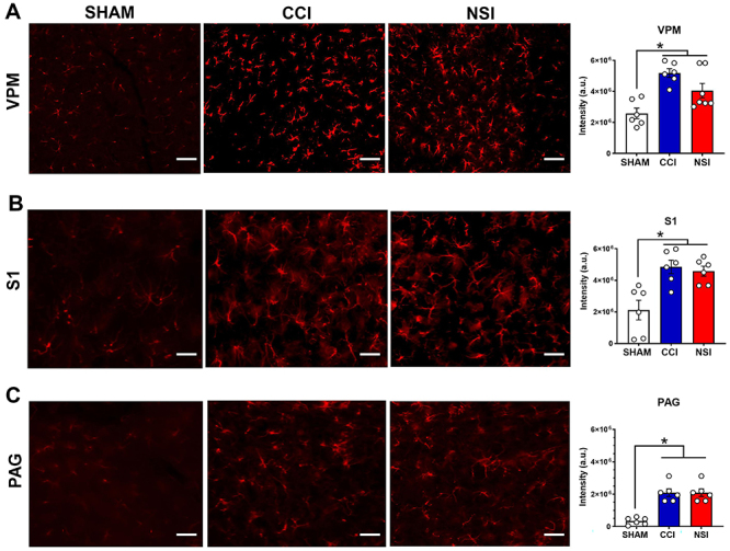 Low-intensity sciatic nerve-stretch injury increases nociception, anxiety-like behaviors, and astrocyte activity in male Wistar rats.