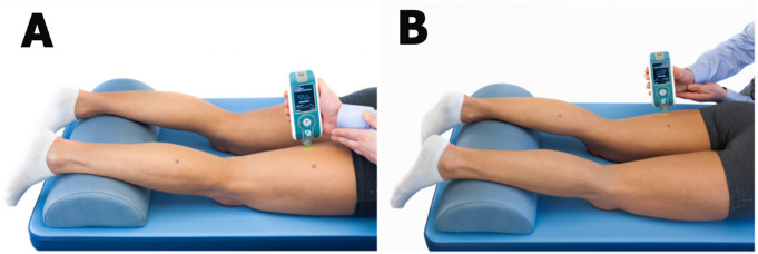 Hamstring Myometric Properties and the Functional Outcome in Young Adults with Radicular Pain: A Cross-Sectional Study.
