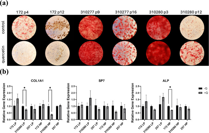Examining the Effects of Quercetin on Phenotypic Characteristics of Human Mesenchymal Stem Cells.