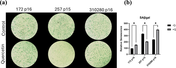 Examining the Effects of Quercetin on Phenotypic Characteristics of Human Mesenchymal Stem Cells.