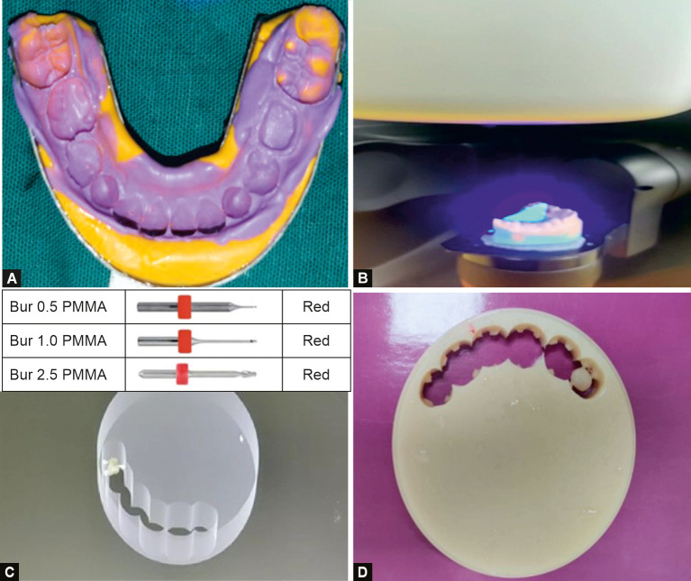 Three-dimensional-printed Photopolymer Resin Crowns vs Computer-aided Milled Polymethyl Methacrylate Crowns with Prefabricated Zirconia Crowns for Primary Molars: A Randomized Clinical Trial.