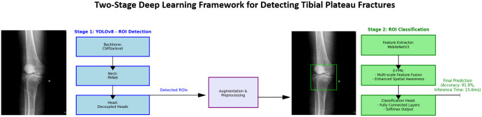 Deep learning diagnosis of adult tibial plateau fractures: multicenter study with external validation.