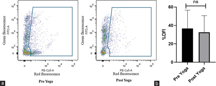 Impact of a 12-week Yoga Intervention on Seminal Oxidative Stress, Sperm Quality, and DNA Fragmentation Index in Infertile Men: A Pre-post Intervention Study.