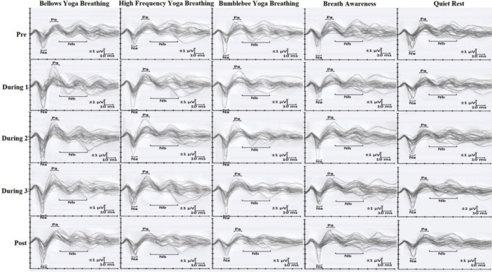 A Comparison of the Effects of Three Volitional Yoga Breathing Practices versus Two Nonvolitional Breathing Controls on Auditory-evoked Potentials.