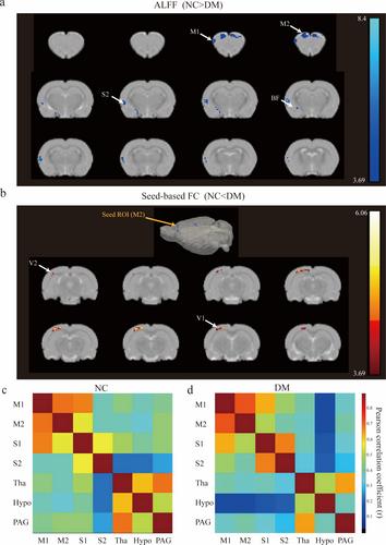 Functional MRI Analysis of Brain Activity in Rats With Diabetic Bladder Dysfunction
