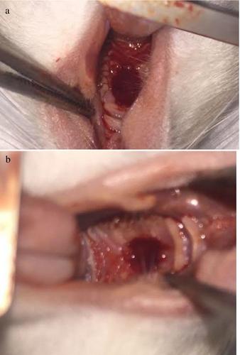 Efficacy of Topical Nigella sativa Oil for Oral Wound Healing in Rats