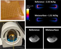 Reduction of radiofrequency induced implant heating via flexible metasurface shielding at 7 T