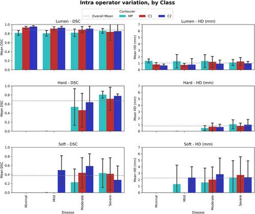 Observer Variability in CT Angiography Carotid Segmentation: Assessing Variability to Set Minimum Clinical Performance