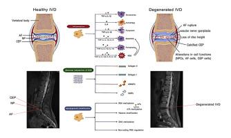 N6-methyladenosine and intervertebral disc degeneration: Advances in detection and pathological insights