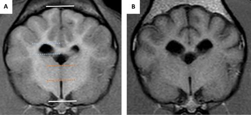 Brain Atrophy in Dogs With Meningoencephalitis of Unknown Origin