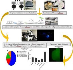 Design and fabrication of a rapid detection biosensor for Candida albicans diagnosis in a microfluidic platform