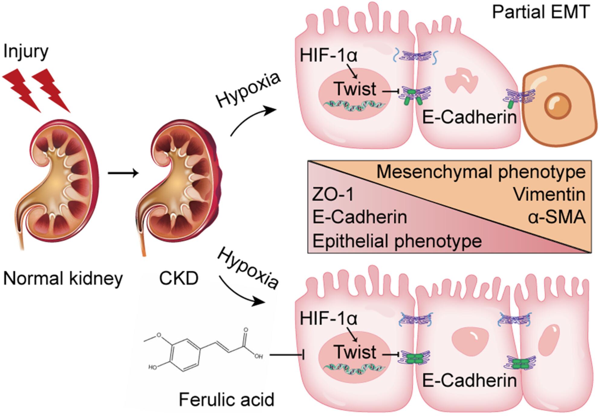 Ferulic Acid Inhibits Partial Epithelial-Mesenchymal Transition in Renal Tubular Epithelial Cells and Mitigates Renal Interstitial Fibrosis by Regulating the HIF-1α/Twist Signaling Pathway