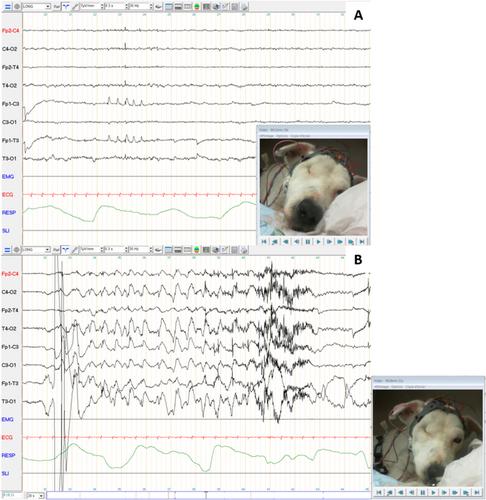 Focal Autonomic Seizures Manifesting With Prevailing Signs of Gastrointestinal Disorder in Dogs