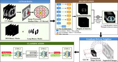Gradient-driven pixel connectivity convolutional neural networks classification based on U-Net lung nodule segmentation