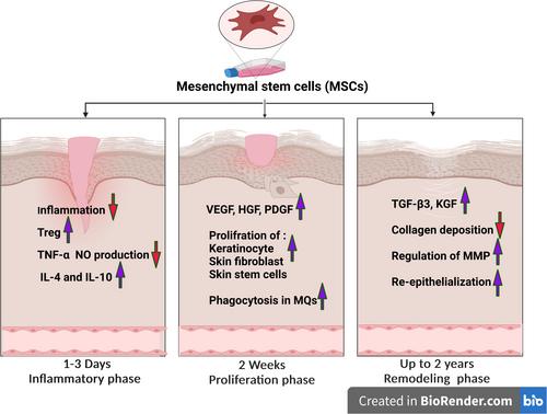 Mesenchymal Stem Cells: A Double-Edged Approach for Managing Cutaneous Leishmaniasis Lesions