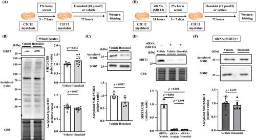 Reduction in Acetylation of Superoxide Dismutase 2 in Skeletal Muscle Improves Exercise Capacity in Mice With Heart Failure
