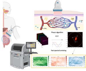 Advancing multispectral optoacoustic tomography (MSOT): Phasor analysis for real-time spectral unmixing