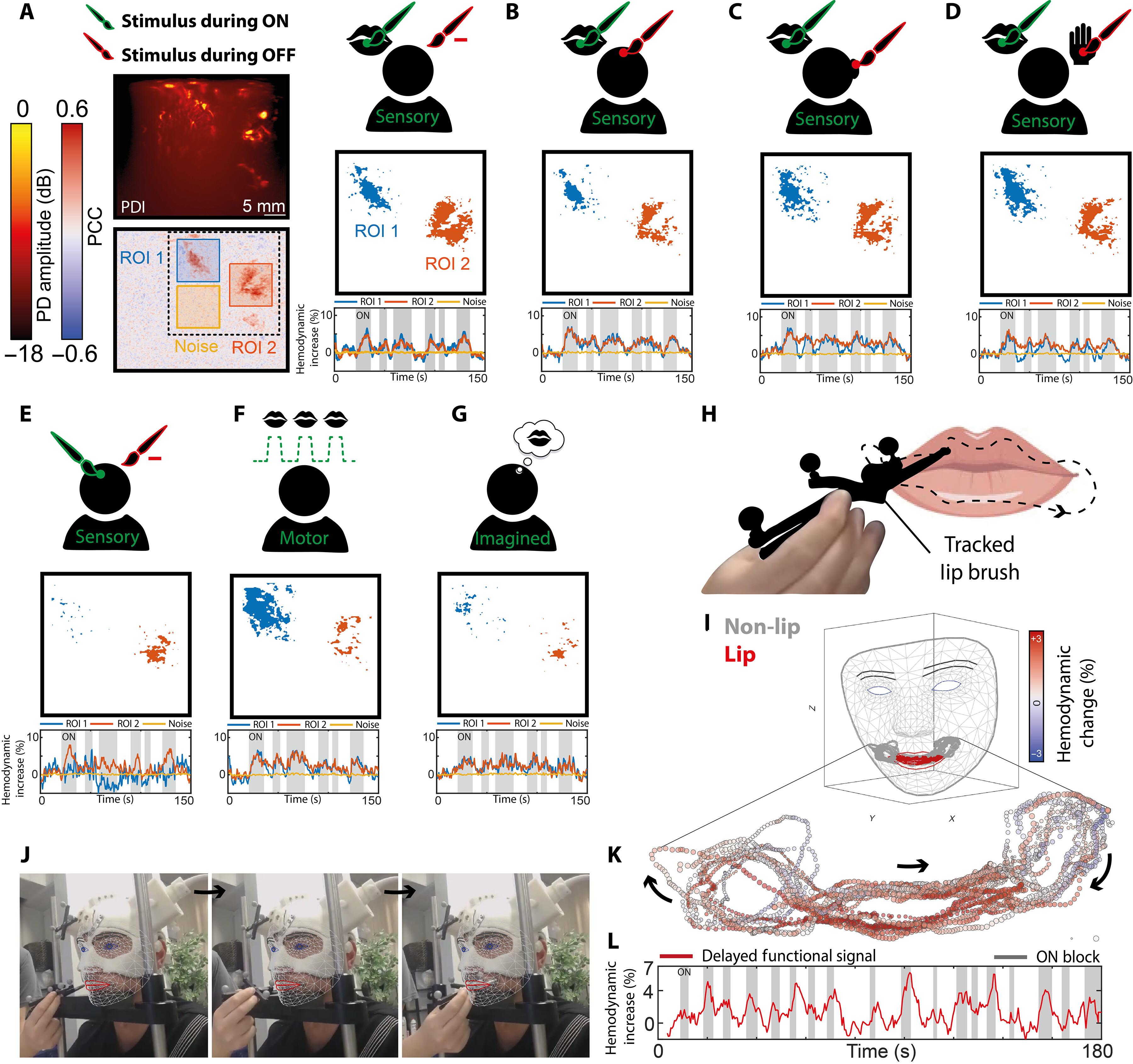 Mobile human brain imaging using functional ultrasound