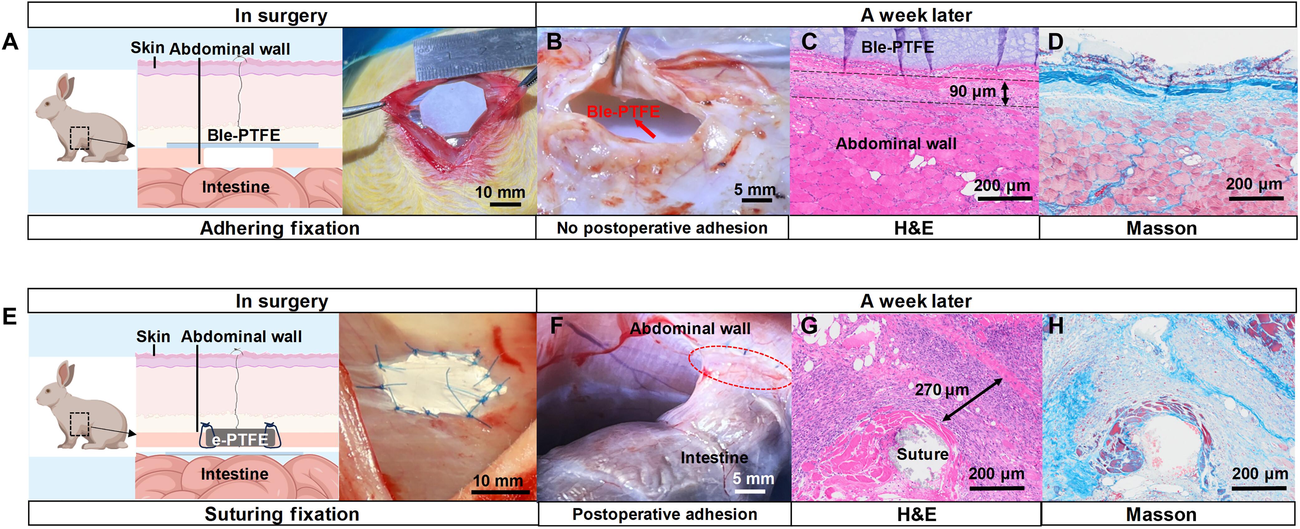Instant and secure fixation of e-PTFE medical implants in surgery by designing a bioadhesive interface