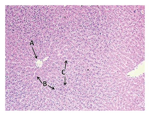 Effects of High Lipid Diet and Bromelain Enzyme on Body Weight, Lipase Gene Expression, and Blood Parameters in Mice BALB/c