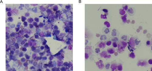 Esophageal Candidiasis in Two Dogs With Megaesophagus: A Case Report