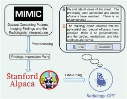 Radiology-GPT: A large language model for radiology