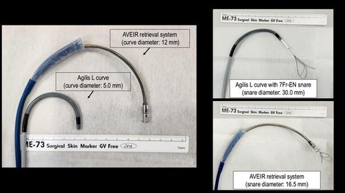 Successful debulking of vegetation extending into the right ventricle using a steerable sheath and leadless retrieval system